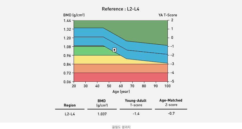 골밀도 결과지