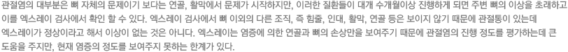 관절염의 대부분은 뼈 자체의 문제이기 보다는 연골, 활막에서 문제가 시작하지만, 이러한 질환들이 대개 수개월이상 진행하게 되면 주변 뼈의 이상을 초래하고 이를 엑스레이 검사에서 확인 할 수 있다. 엑스레이 검사에서 뼈 이외의 다른 조직, 즉 힘줄, 인대, 활막, 연골 등은 보이지 않기 때문에 관절통이 있는데 엑스레이가 정상이라고 해서 이상이 없는 것은 아니다. 엑스레이는 염증에 의한 연골과 뼈의 손상만을 보여주기 때문에 관절염의 진행 정도를 평가하는데 큰 도움을 주지만, 현재 염증의 정도를 보여주지 못하는 한계가 있다.